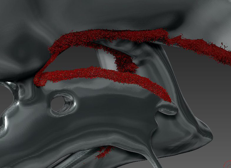 zbrush ventricles choroid plexus closeup by michelle davis
